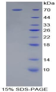 Rat CD14 Protein (Recombinant His-GST)