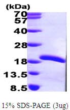 Human MMS2 / UBE2V2 Protein (Recombinant His)