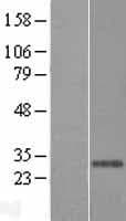 BAR / BFAR Protein (Over-Expression Lysate Myc-DDK (Flag))