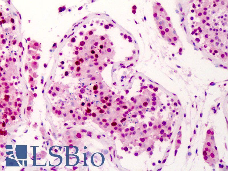 IHC-plus™ SUPT16H / FACTP140 Antibody (aa321-640)