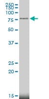 IHC-plus™ MECP2 Antibody (clone 4B6)