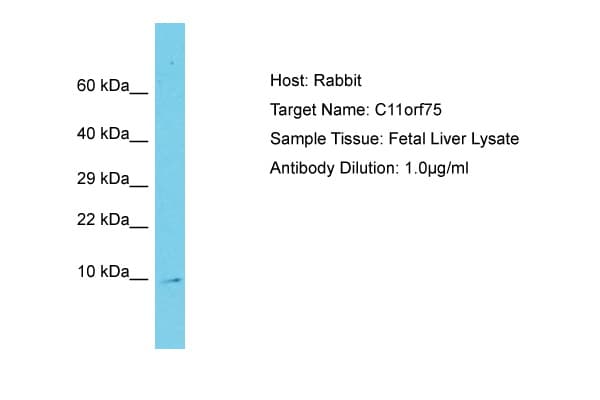 Polyclonal Rabbit anti-Human SMCO4 Antibody (C-Terminus, WB)