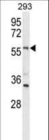 Polyclonal Rabbit anti-Human LMBR1L Antibody (aa462-489, IHC, WB)