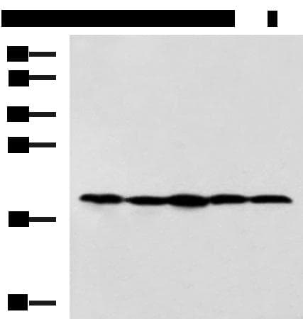 RPS11 / Ribosomal Protein 11 Antibody