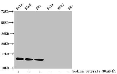 HIST1H2BN Antibody