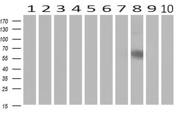 CD19 Antibody (clone UMAB103)