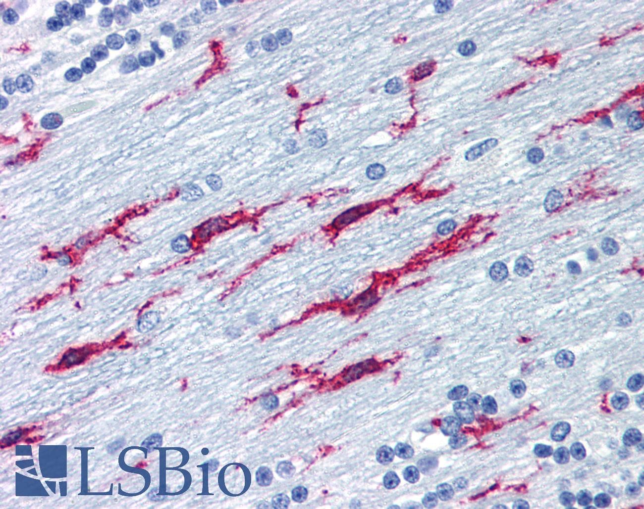 IHC-plus™ Monoclonal Mouse anti-Human ITGB2 / CD18 Antibody (clone MEM-48, IHC, WB)