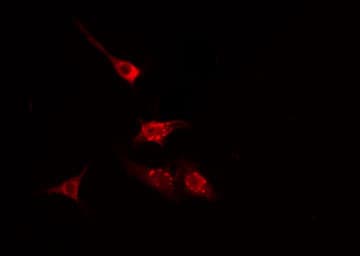 CTNNB1 / Beta Catenin Antibody (phospho-Ser37,pSer33,pThr41)