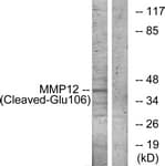 MMP12 Antibody (aa87-136)