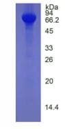 Human HRG Protein (Recombinant His, N-Terminal)