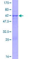 Human CDK3 Protein (Recombinant GST)