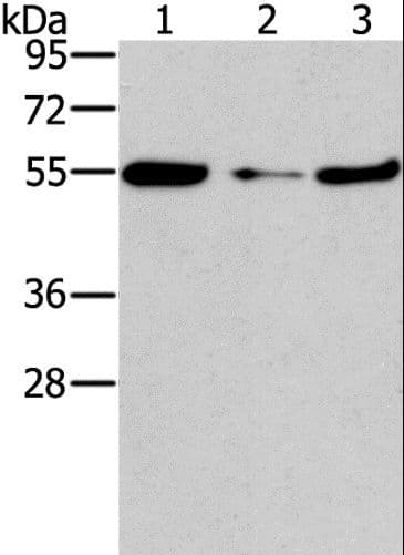 FGFR1OP / FOP Antibody
