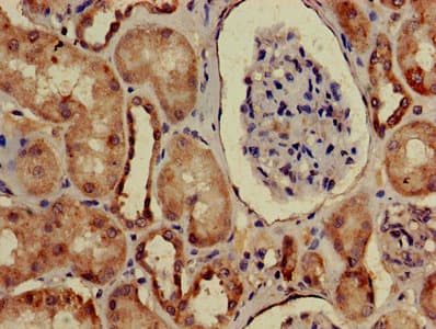 Polyclonal Rabbit anti-Human ARHGAP25 Antibody (IHC)
