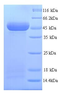 Human WNT10A Protein (Recombinant 6His, N-terminus)