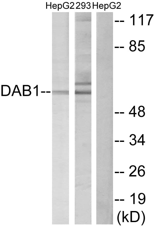 IHC-plus™ Polyclonal Rabbit anti-Human DAB1 Antibody (aa199-248, IHC, IF, WB)
