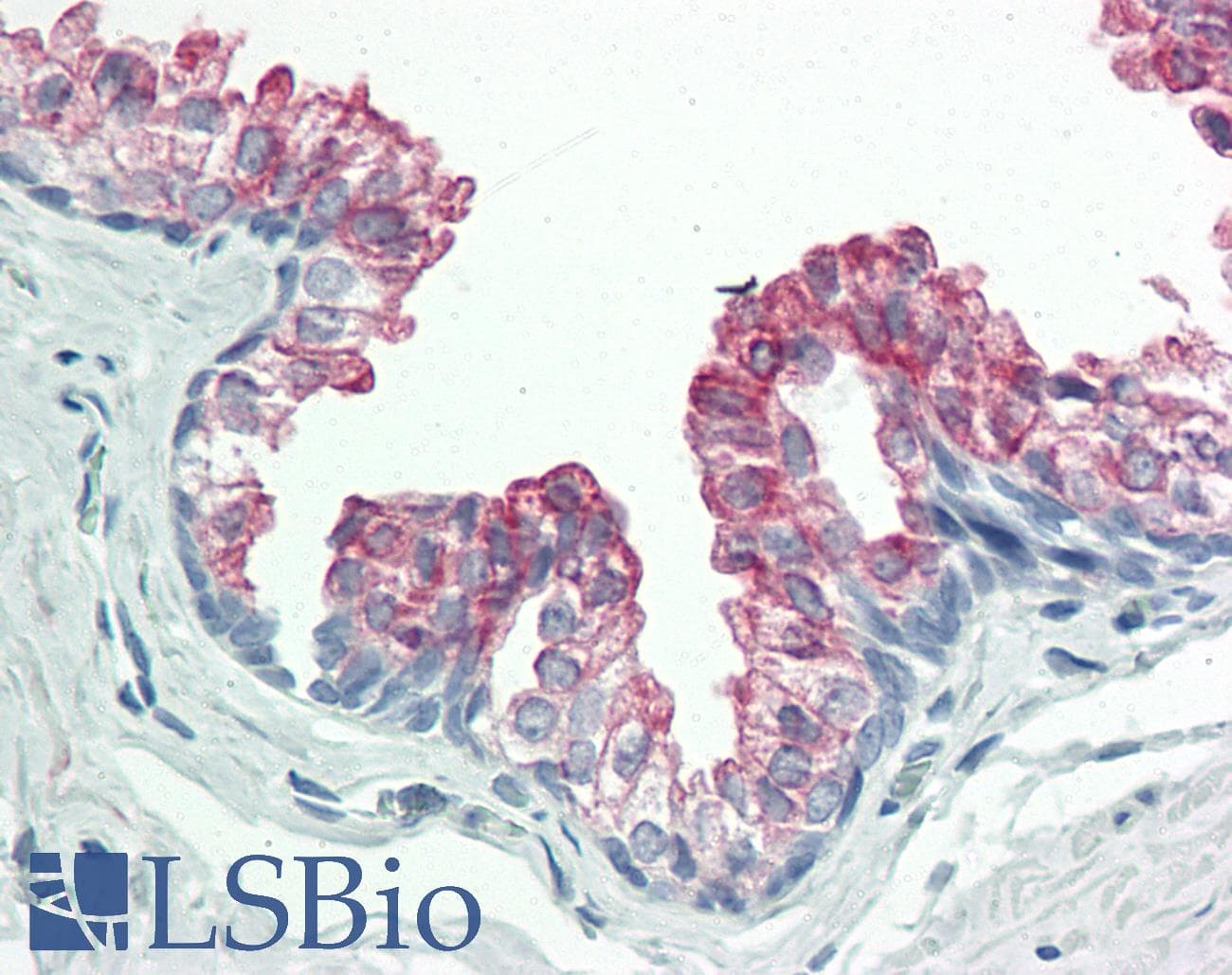 Polyclonal Rabbit anti-Human BAP / SIL1 Antibody (aa360-409, IHC, WB)