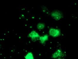 PGAM2 Antibody (clone OTI3B11)