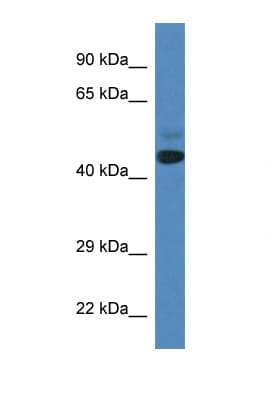 Polyclonal Rabbit anti-Human SPRYD3 Antibody (aa98-147, WB)