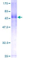 Human FBXL20 Protein (Recombinant GST)