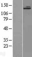 ALPK1 Protein (Over-Expression Lysate Myc-DDK (Flag))