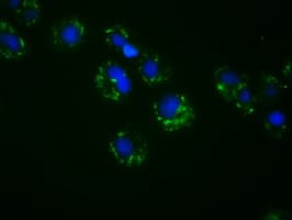 ACSBG1 / hsBG Antibody (clone OTI2B5)