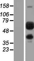 PGM1 / Phosphoglucomutase 1 Protein (Over-Expression Lysate Myc-DDK (Flag))