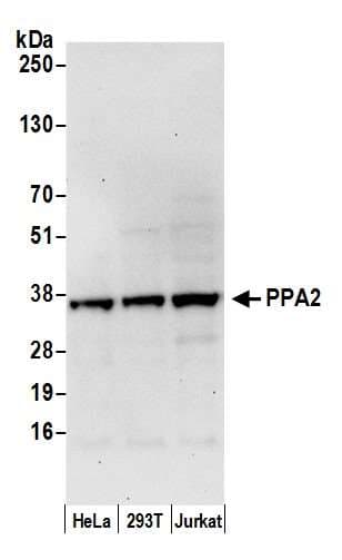 Polyclonal Rabbit anti-Human PPA2 Antibody (aa25-75, WB)