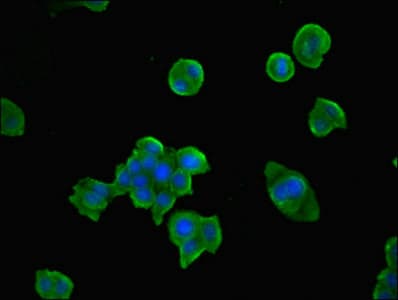 Polyclonal Rabbit anti-Human TPK1 Antibody (IHC, IF, WB)