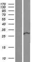 RNF125 / TRAC-1 Protein (Over-Expression Lysate Myc-DDK (Flag))