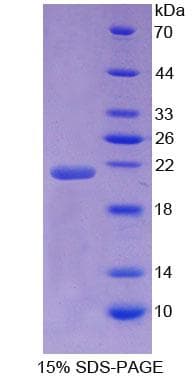 Human NSF Protein (Recombinant His-T7)