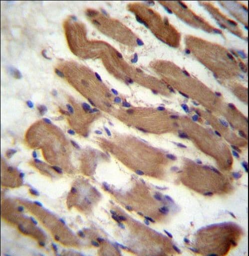 PALMD Antibody (aa41-69)