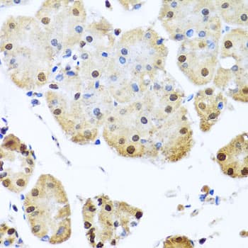 Polyclonal Rabbit anti-Human NUMA1 / NUMA Antibody (IHC, IF, WB)
