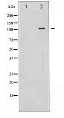 NFKB2 Antibody