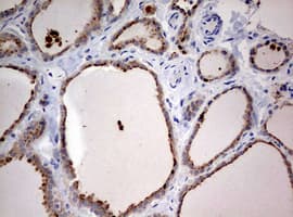 STK11 / LKB1 Antibody (aa1-236, clone OTI0A3)