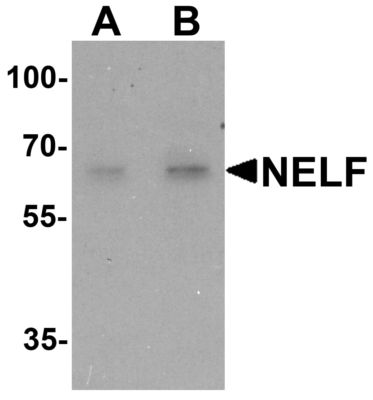 NSMF / NELF Antibody