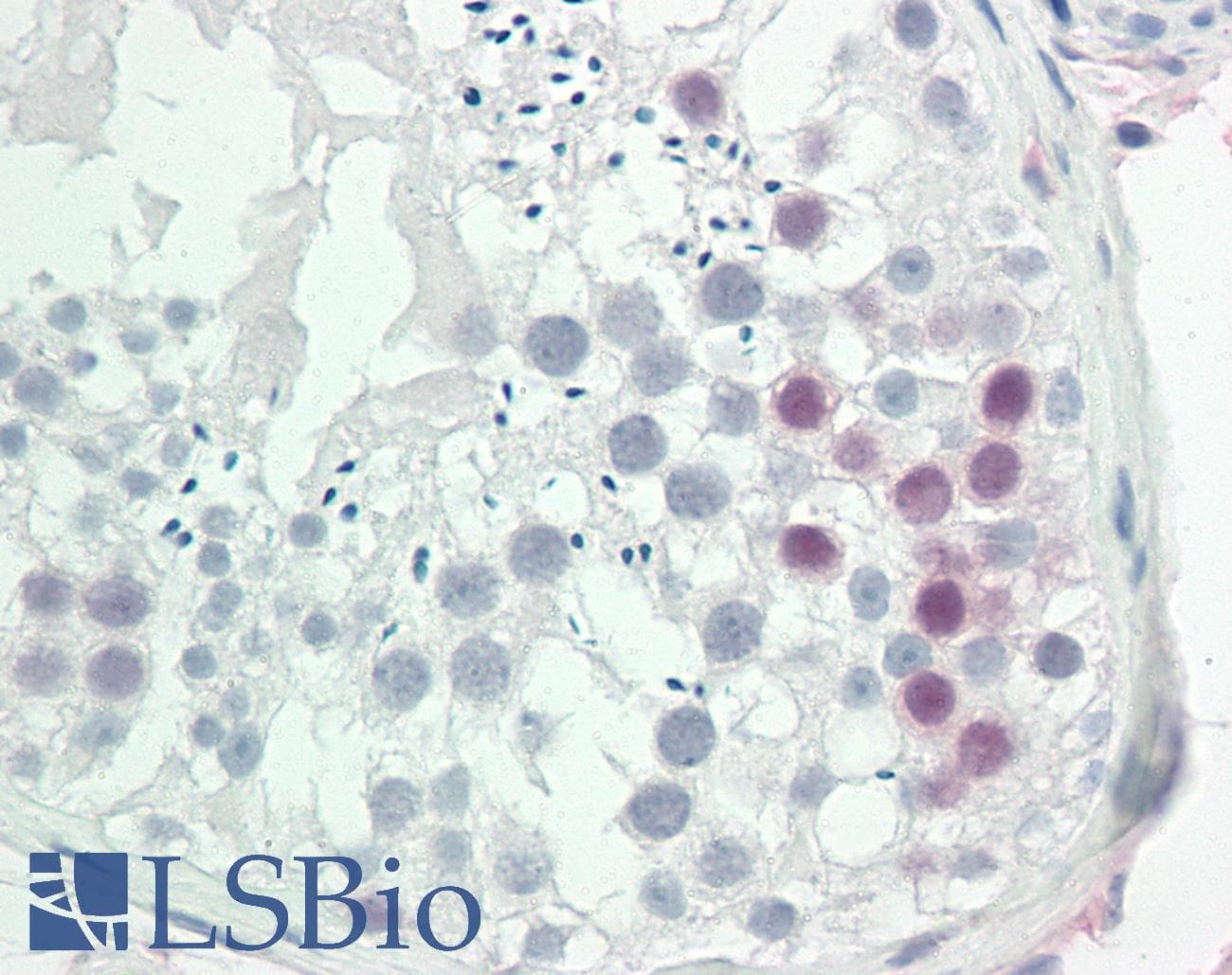 IHC-plus™ Monoclonal Mouse anti-Human CHEK1 / CHK1 Antibody (clone 2G1D5, IHC, WB)