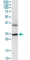 BDNF Antibody (clone 1B10)