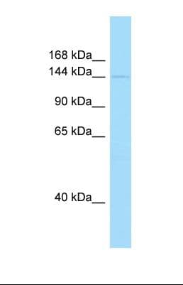 Polyclonal Rabbit anti-Human PIK3C2A Antibody (aa1592-1641, WB)