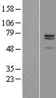 Human Carboxypeptidase Z / CPZ Protein (Over-Expression Lysate Myc-DDK (Flag))
