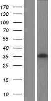 RDH16 Protein (Over-Expression Lysate Myc-DDK (Flag))