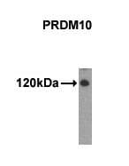 PRDM10 / TRIS Antibody (N-Terminus, clone 48AT1224.90.46)