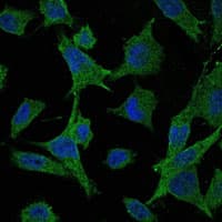 MAP2K6 / MEK6 / MKK6 Antibody (clone 3H12C8)