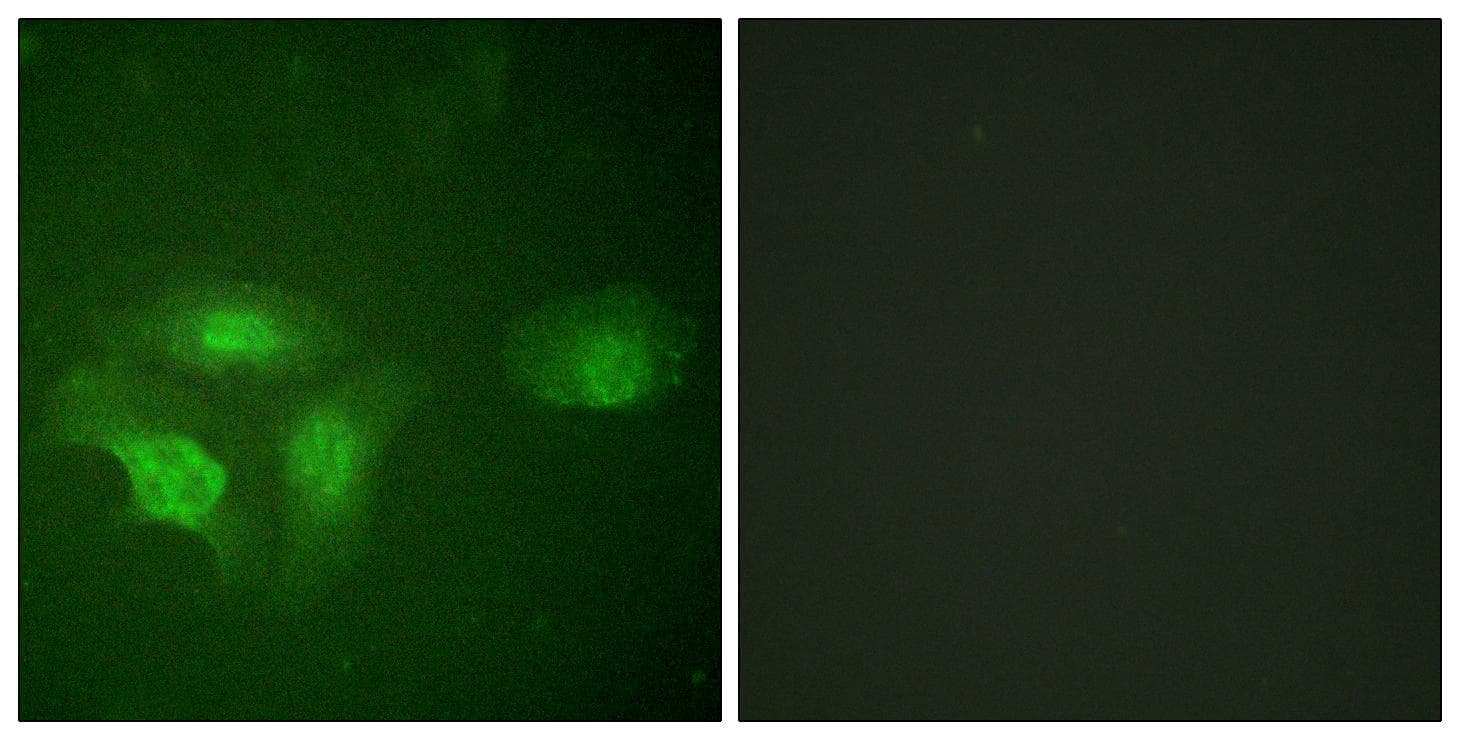 HDAC6 Antibody (phospho-Ser22)