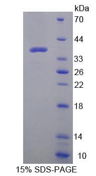 Human DEFA1 / Defensin Alpha 1 Protein (Recombinant His-GST)
