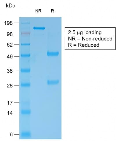 PathPlus™ BCL2 / Bcl-2 Antibody (clone rBCL2/796)