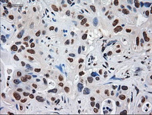 Alpha-Fetoprotein Antibody (aa19-397, clone OTI2F11, Carrier-free)