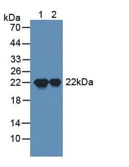 SPA17 / Sperm Protein 17 Antibody (aa1-149)