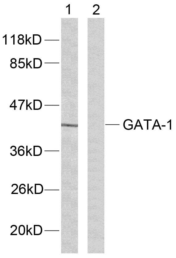 GATA1 Antibody (p142)