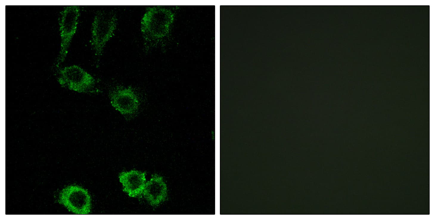 Polyclonal Rabbit anti-Human CNN2 Antibody (aa121-170, IF, WB)