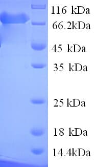 Human PARN Protein (Recombinant His)